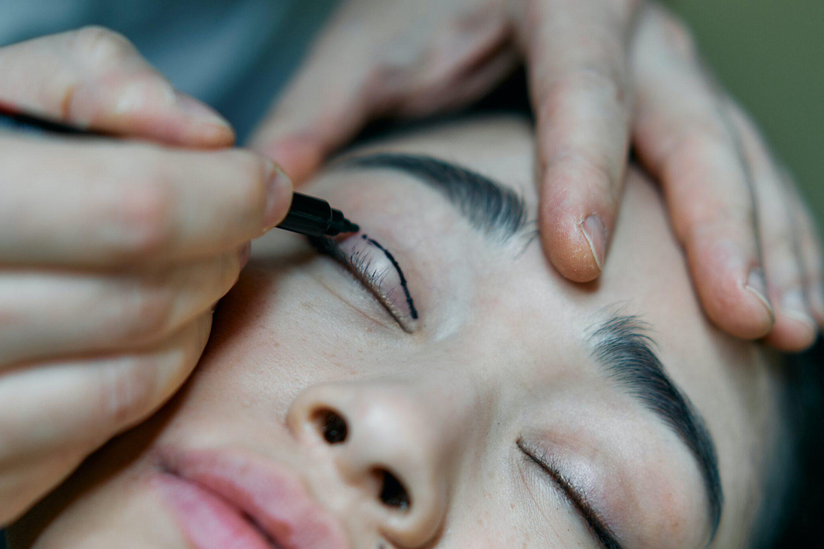 Close-up of a patient’s closed eye being marked for eyelid surgery, preparing for a long-lasting cosmetic enhancement.