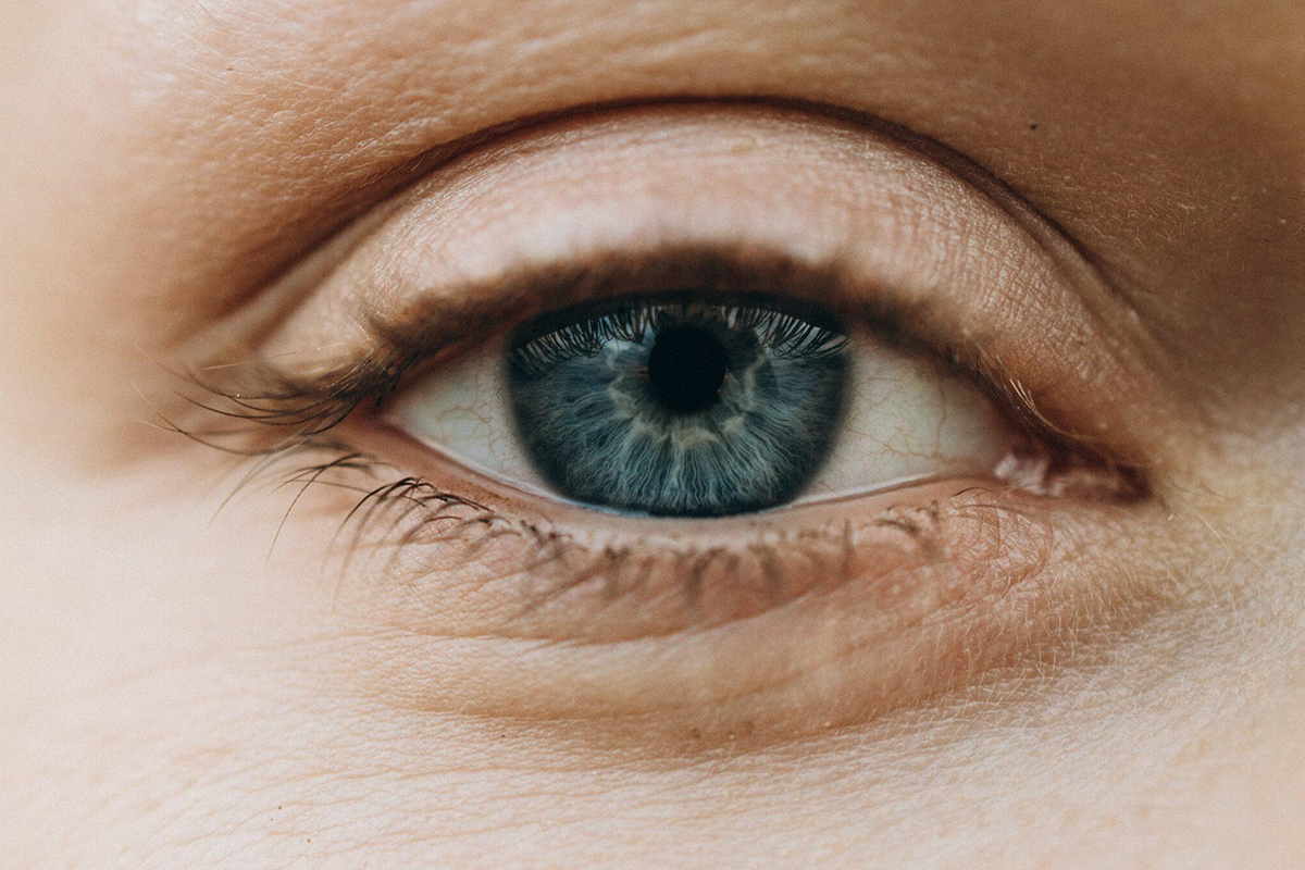 Close-up of a blue eye with mild upper eyelid sagging, showing signs of aging and potential for non-surgical treatment.