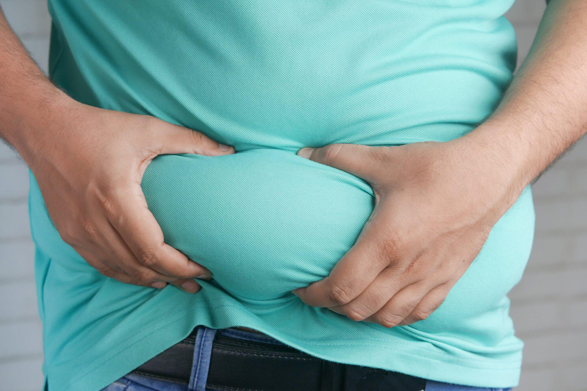 Man gripping abdominal fat through turquoise shirt, illustrating common area for liposuction fat removal candidacy.