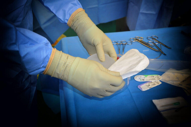 Surgeon preparing breast implant on sterile table with tools, highlighting surgical care and implant longevity expectations.