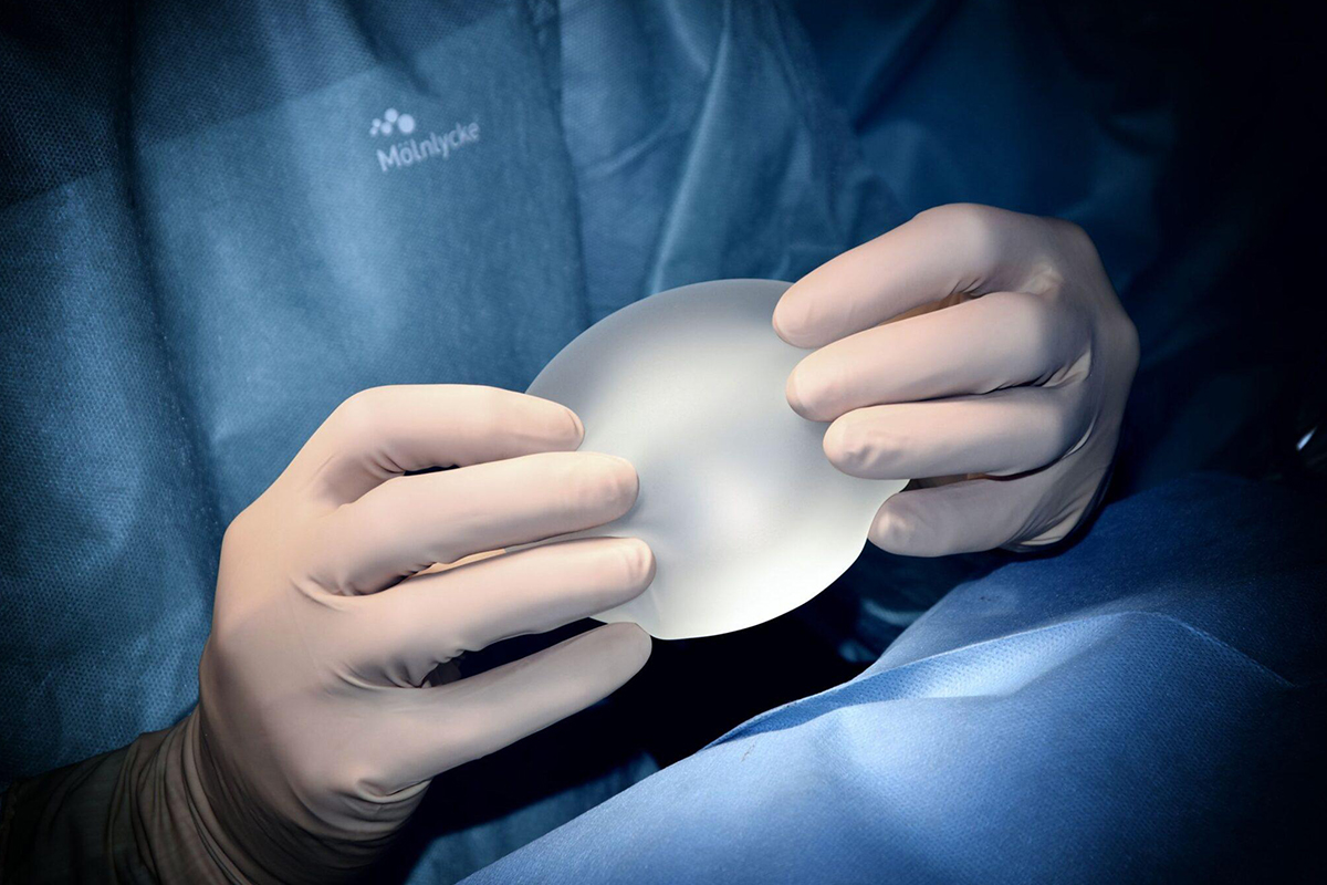 Gloved surgeon holding silicone breast implant in operating room before performing revision surgery for implant replacement.