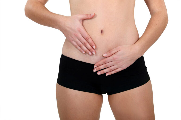 Woman holding lower abdomen, highlighting area for potential medically necessary tummy tuck