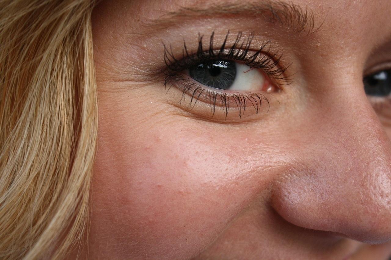 Is Botox Safe for Crows Feet? featured image